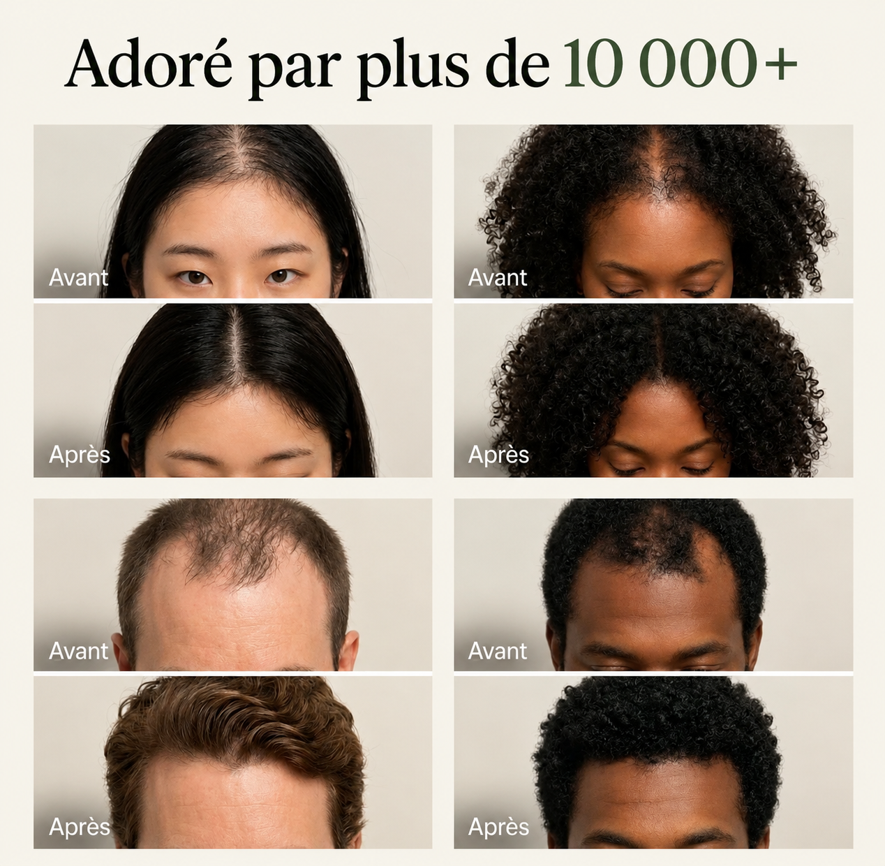 Barre revitalisante coréenne pour le cuir chevelu