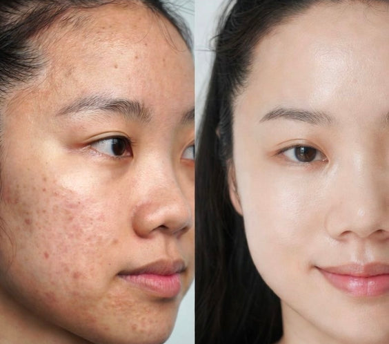 Aqua Ultra Kit ( 67pcs )