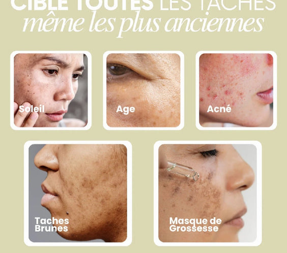 Skin AquaSeoul
